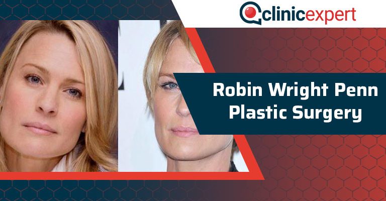 Robin Wright Penn Plastic Surgery