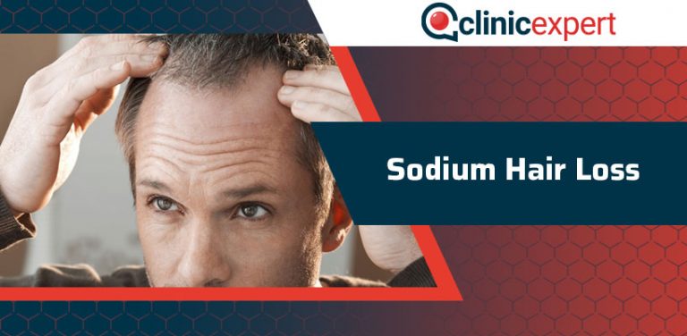 sodium-hair-loss-clinicexpert