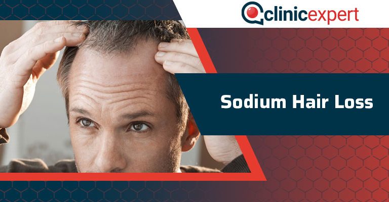 Sodium Hair Loss