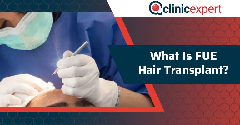 What Is FUE Hair Transplant?