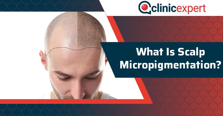 What Is Scalp Micropigmentation?