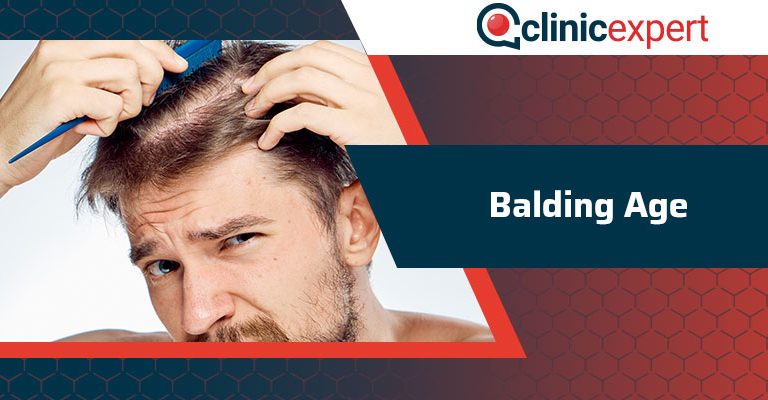 Balding Age