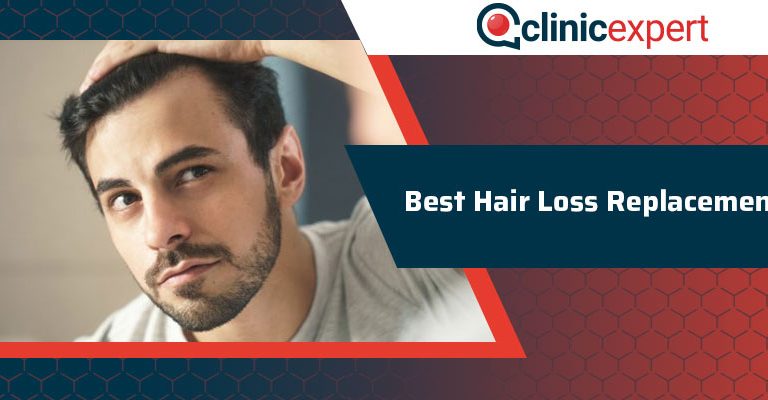 Best Hair Loss Replacement