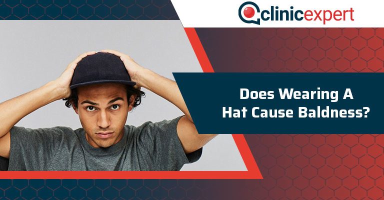 Does Wearing A Hat Cause Baldness?