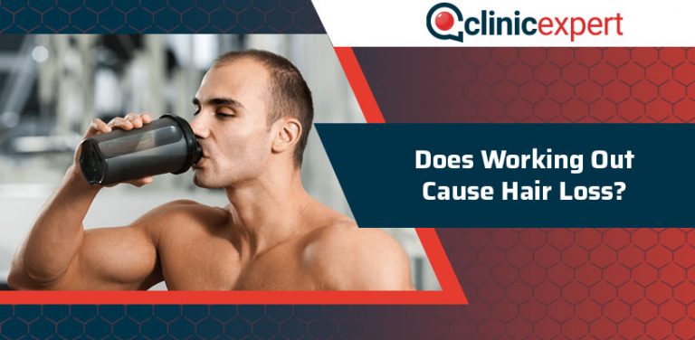 does-working-out-cause-hair-loss-clinicexpert