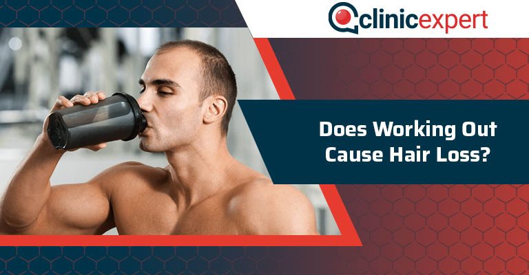 Does Working Out Cause Hair Loss?