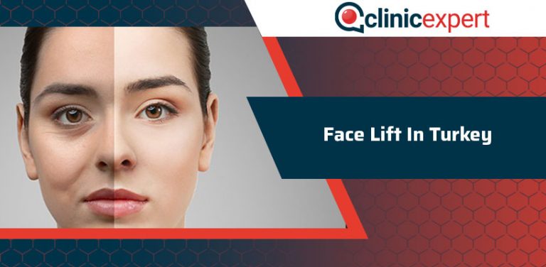 face-lift-in-turkey-clinicexpert-international