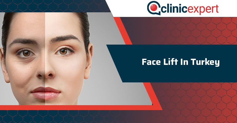 Face Lift operation In Turkey