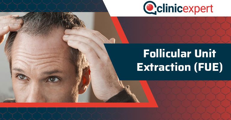 Follicular Unit Extraction (FUE)