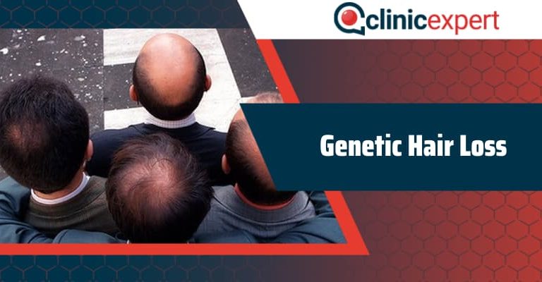 Curing Genetic Hair Loss