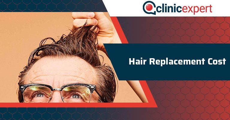 Hair Replacement Cost