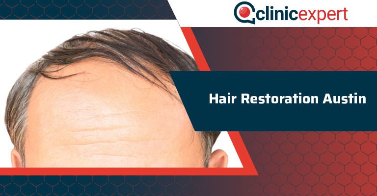 Hair Restoration Austin