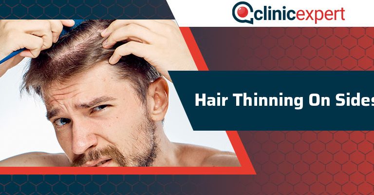 Hair Thinning On Sides