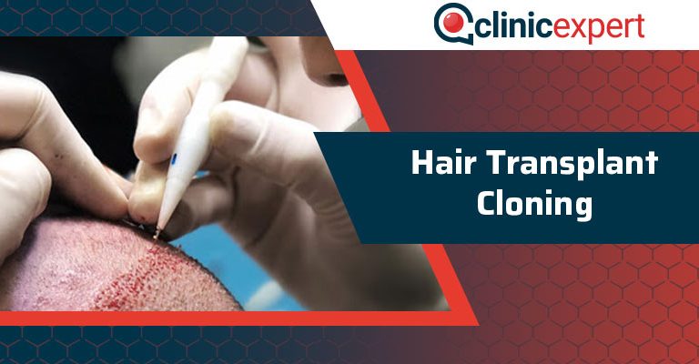 Hair Transplant Cloning