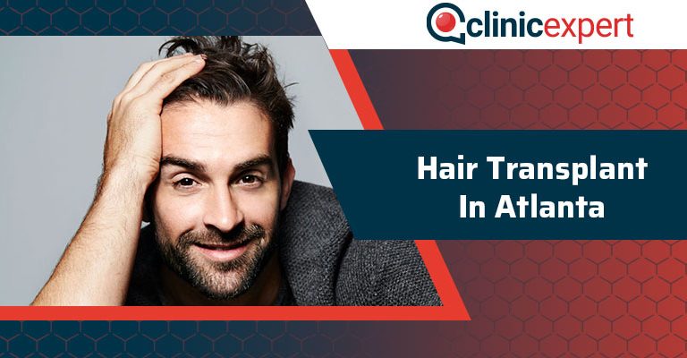 Hair Transplant In Atlanta