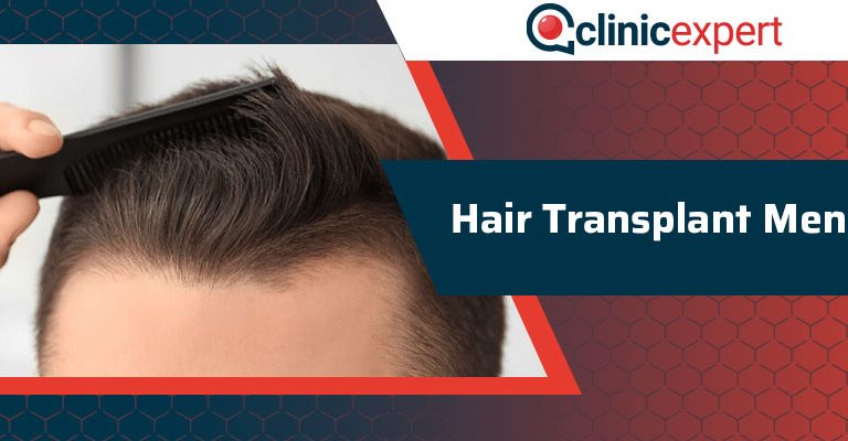 Hair Transplant Men