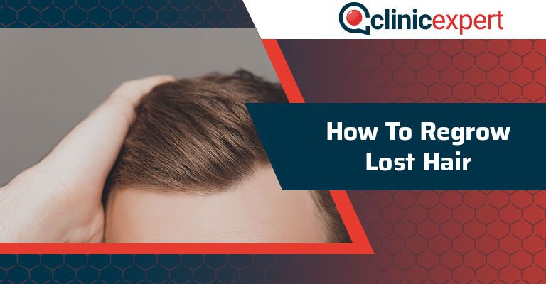 How To Regrow Lost Hair?