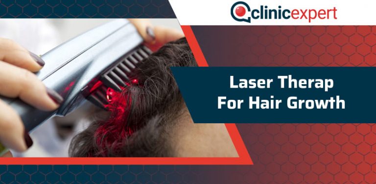 Laser Therapy for Hair Growth ClinicExpert International