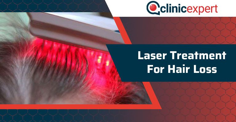 Laser Treatment For Hair Loss