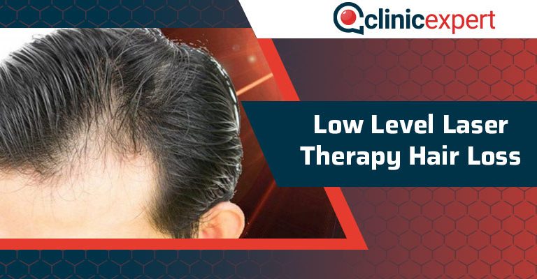 Low Level Laser Therapy Hair Loss