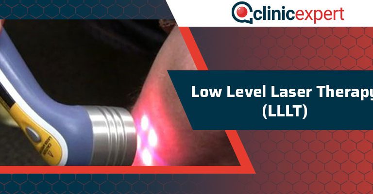 Low Level Laser Therapy (LLLT)