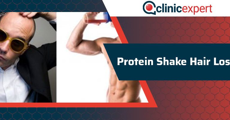 Protein Shake Hair Loss