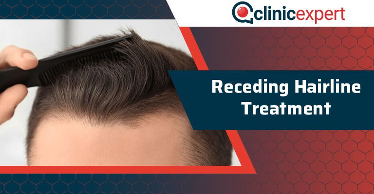 Receding Hairline Treatment