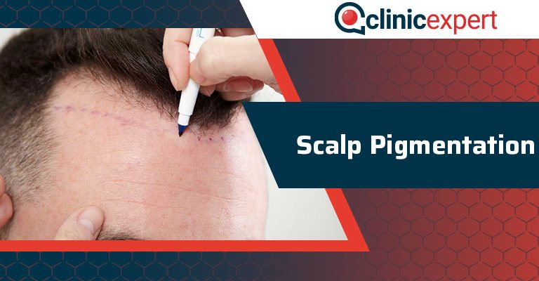 Scalp Pigmentation