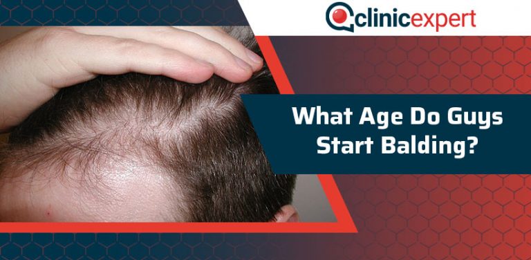 what-age-do-guys-start-balding-clinicexpert-international-healthcare