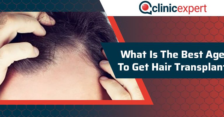 What Is The Best Age To Get A Hair Transplant?