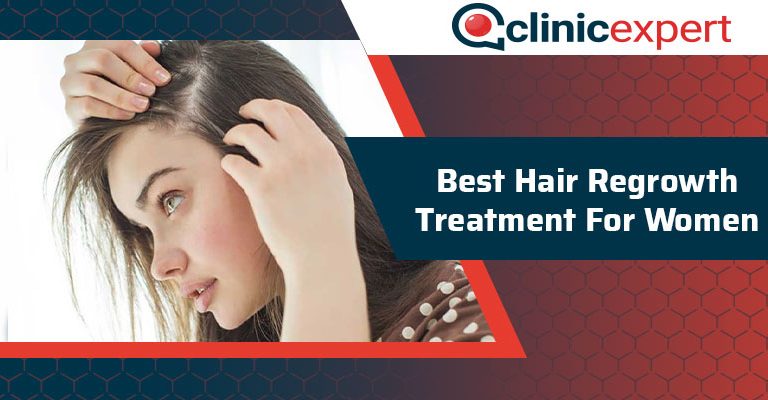 Best Hair Regrowth Treatment For Women