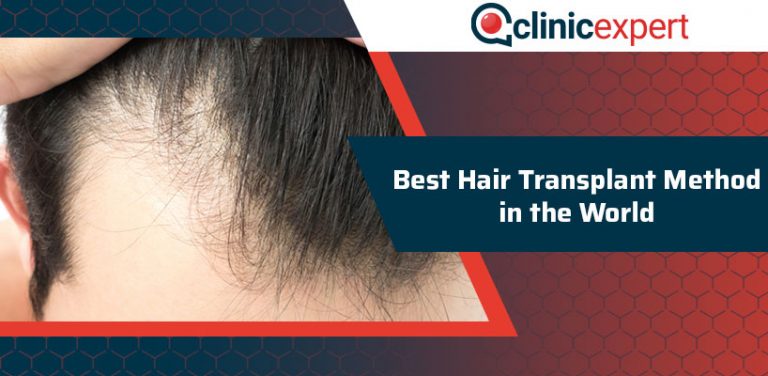 Best Hair Transplant Method In The World Clinicexpert 2526