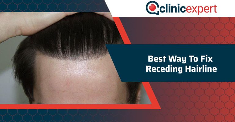 Best Way To Fix Receding Hairline