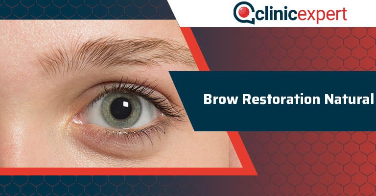 Brow Restoration Natural