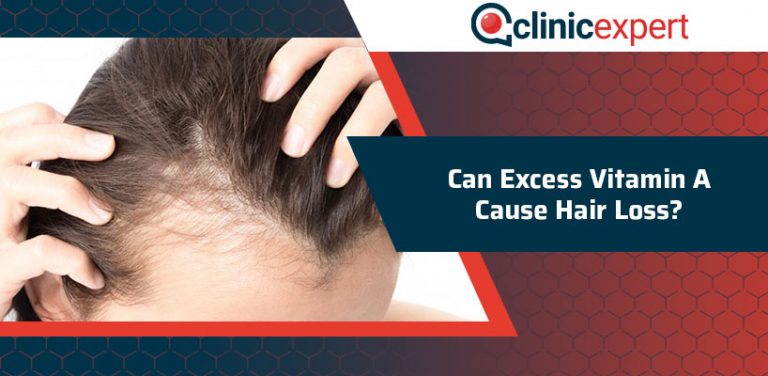 can-excess-vitamin-a-cause-hair-loss-clinicexpert