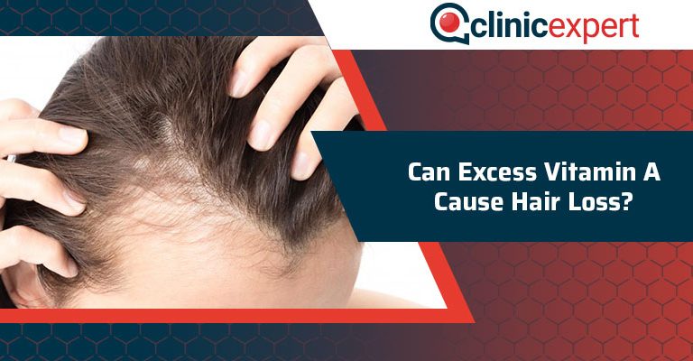 Can Excess Vitamin A Cause Hair Loss?