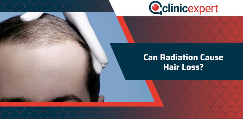 Can Radiation Cause Hair Loss ClinicExpert