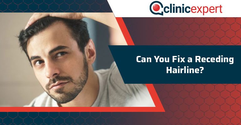 Can You Fix A Receding Hairline?