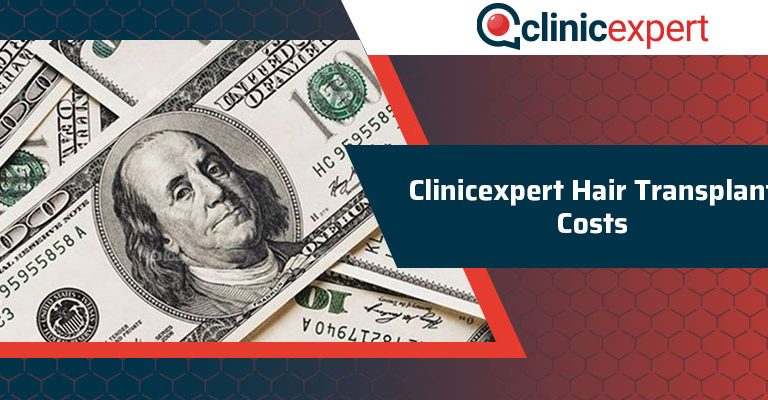 Clinicexpert Hair Transplant Costs