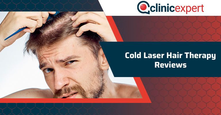 Cold Laser Hair Therapy Reviews