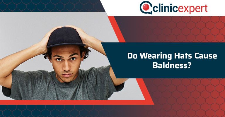 Do Wearing Hats Cause Baldness?