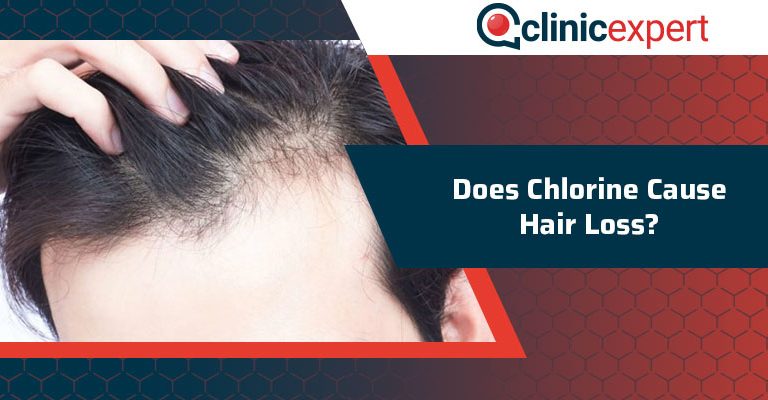 Does Chlorine Cause Hair Loss?