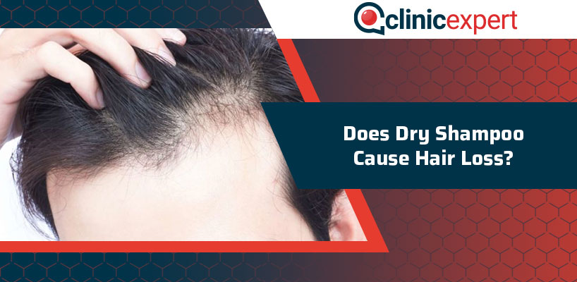 Does Dry Shampoo Cause Hair Loss ClinicExpert