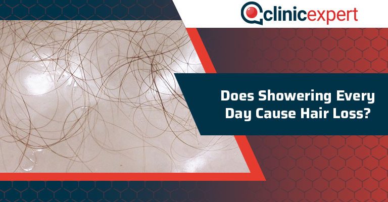 Does Showering Every Day Cause Hair Loss?