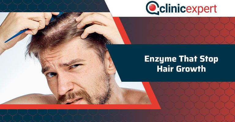 Enzyme That Stop Hair Growth