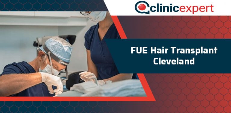 FUE Hair Transplant Cleveland ClinicExpert International