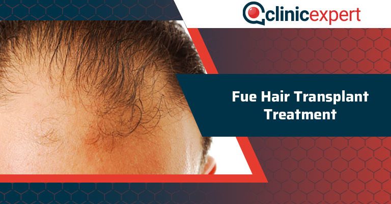 Fue Hair Transplant Treatment 