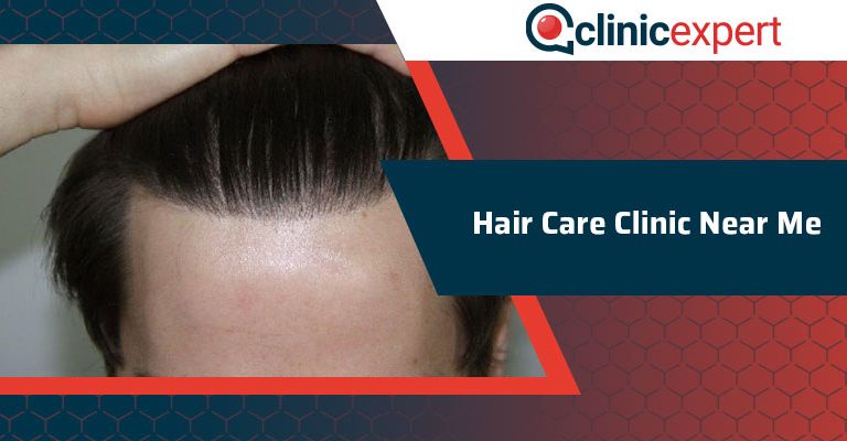 Hair Care Clinic Near Me  