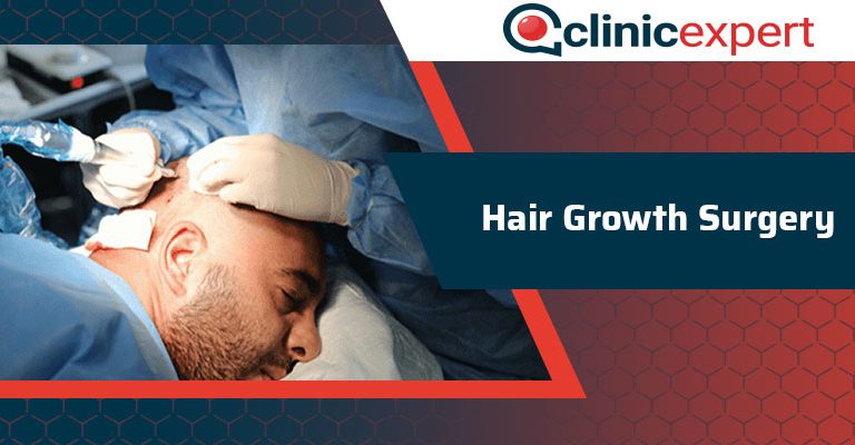 Hair Growth Surgery