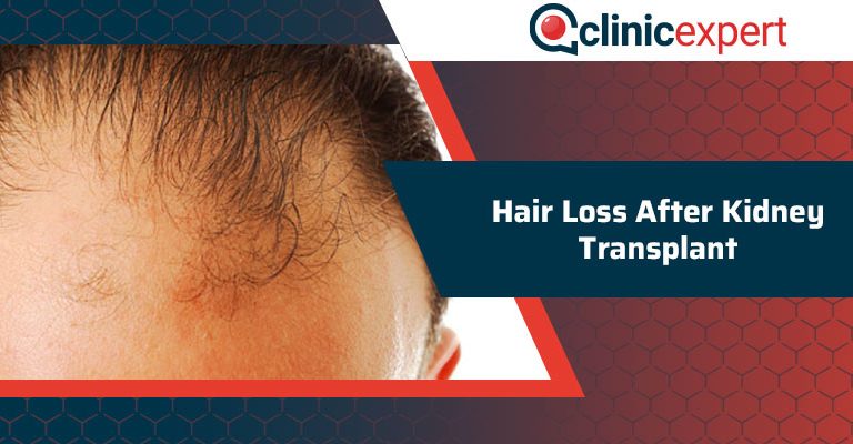 Hair Loss After Kidney Transplant